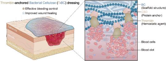 Chinese team creates bacterial cellulose-based dressing for burn wound healing